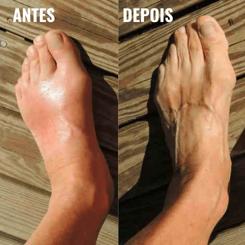 Tornozeleira Ortopédica Comfort Feet